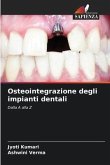 Osteointegrazione degli impianti dentali