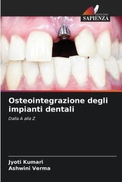 Osteointegrazione degli impianti dentali - Kumari, Jyoti;Verma, Ashwini