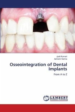 Osseointegration of Dental Implants - Kumari, Jyoti;Verma, Ashwini