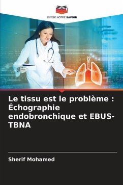 Le tissu est le problème : Échographie endobronchique et EBUS-TBNA - Mohamed, Sherif