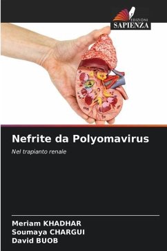 Nefrite da Polyomavirus - Khadhar, Meriam;CHARGUI, Soumaya;BUOB, David