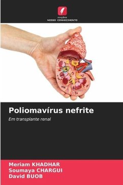 Poliomavírus nefrite - Khadhar, Meriam;CHARGUI, Soumaya;BUOB, David