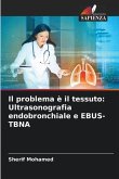 Il problema è il tessuto: Ultrasonografia endobronchiale e EBUS-TBNA
