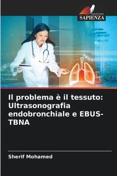 Il problema è il tessuto: Ultrasonografia endobronchiale e EBUS-TBNA - Mohamed, Sherif