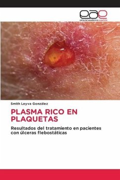 PLASMA RICO EN PLAQUETAS