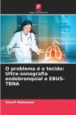 O problema é o tecido: Ultra-sonografia endobronquial e EBUS-TBNA