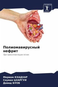Cover Poliomawirusnyj nefrit