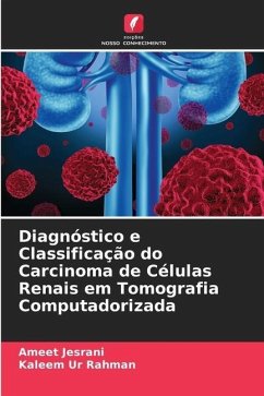 Diagnóstico e Classificação do Carcinoma de Células Renais em Tomografia Computadorizada - Jesrani, Ameet;Rahman, Kaleem Ur