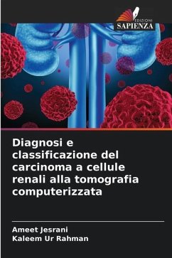 Diagnosi e classificazione del carcinoma a cellule renali alla tomografia computerizzata - Jesrani, Ameet;Rahman, Kaleem Ur