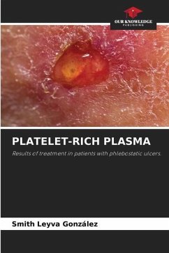 PLATELET-RICH PLASMA - Leyva González, Smith