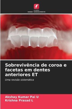 Sobrevivência de coroa e facetas em dentes anteriores ET - Pai U, Akshay Kumar;L, Krishna Prasad