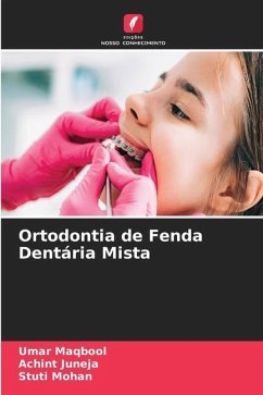 Ortodontia de Fenda Dentária Mista - Maqbool, Umar;JUNEJA, ACHINT;Mohan, Stuti