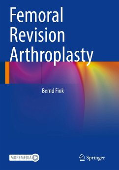 Femoral Revision Arthroplasty - Fink, Bernd