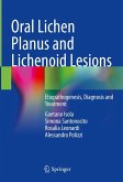 Oral Lichen Planus and Lichenoid Lesions