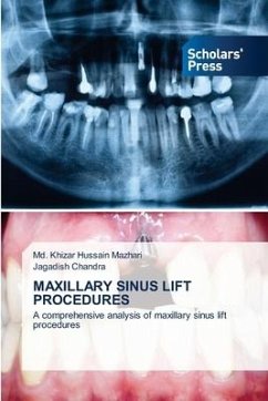 MAXILLARY SINUS LIFT PROCEDURES - Mazhari, Md. Khizar Hussain;Chandra, Jagadish