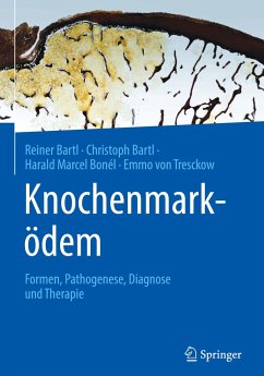 Knochenmarködem - Bartl, Reiner;Bartl, Christoph;Bonél, Harald Marcel