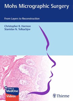 Mohs Micrographic Surgery: From Layers to Reconstruction (eBook, ePUB) - Harmon, Christopher B.; Tolkachjov, Stanislav N.