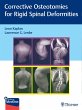Corrective Osteotomies for Rigid Spinal... - Bild 1