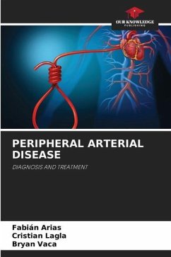 PERIPHERAL ARTERIAL DISEASE - Arias, Fabián;Lagla, Cristian;Vaca, Bryan