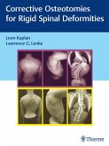 Corrective Osteotomies for Rigid Spinal Deformities (eBook, ePUB)