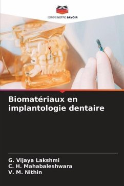 Biomatériaux en implantologie dentaire - Vijaya Lakshmi, G.;Mahabaleshwara, C. H.;Nithin, V. M.