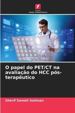 O papel do PET/CT na avaliação do HCC pós-terapêutico - Sameh Soliman, Sherif