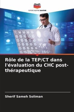 Rôle de la TEP/CT dans l'évaluation du CHC post-thérapeutique - Sameh Soliman, Sherif