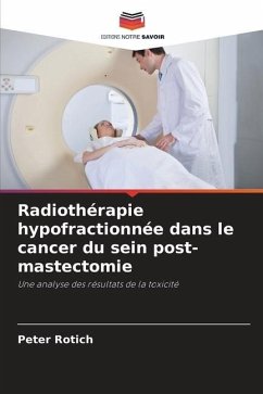 Radiothérapie hypofractionnée dans le cancer du sein post-mastectomie - Rotich, Peter