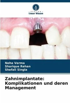 Zahnimplantate: Komplikationen und deren Management - Verma, Neha;Rehan, Sharique;Singla, Shefali