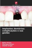 Implantes dentários: complicações e sua gestão