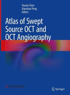 Atlas of Swept Source OCT and OCT Angiography (eBook, PDF)