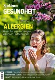 Spektrum Gesundheit - Allergien (eBook, PDF)