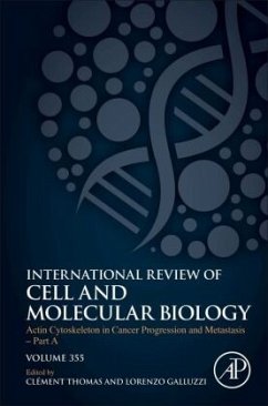 Actin Cytoskeleton in Cancer Progression and Metastasis - Part A