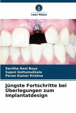 Jüngste Fortschritte bei Überlegungen zum Implantatdesign - Boya, Savitha Rani;Gottumukkala, Sujani;Krishna, Pavan Kumar