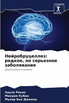 Nejrobrucellez: redkoe, no ser'eznoe zabolewanie - Rekik, Haula;Kubaa, Makram;Ben Dzhemaa, Munir