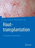 Hauttransplantation (eBook, PDF)