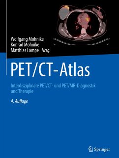 PET/CT-Atlas