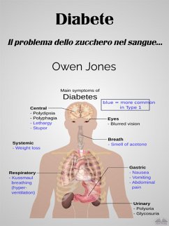 Diabete (eBook, ePUB) - Jones, Owen