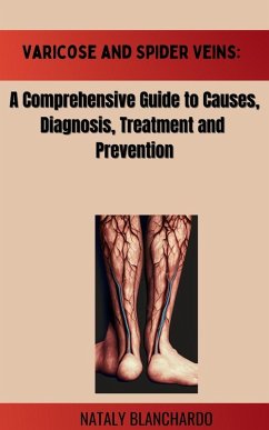 Cover Varicose and Spider Veins: A Comprehensive Guide to Causes,Diagnosis, Treatment and Prevention (eBook, ePUB)