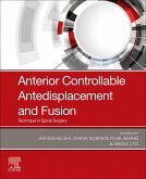Anterior Controllable Antedisplacement and Fusion Anterior Controllable Antedisplacement and Fusion