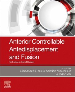 Cover Anterior Controllable Antedisplacement and Fusion