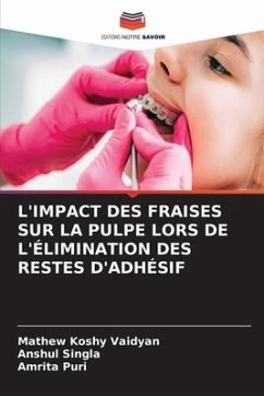 L'IMPACT DES FRAISES SUR LA PULPE LORS DE L'ÉLIMINATION DES RESTES D'ADHÉSIF - Koshy Vaidyan, Mathew;SINGLA, ANSHUL;Puri, Amrita