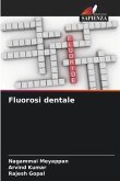 Fluorosi dentale