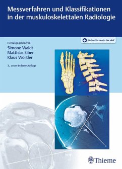 Messverfahren und Klassifikationen in der muskuloskelettalen Radiologie (eBook, PDF) - Waldt, Simone; Eiber, Matthias; Wörtler, Klaus