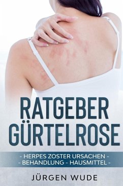 Ratgeber Gürtelrose - Wude, Jürgen