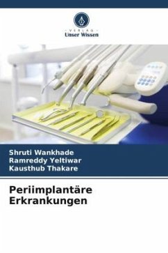 Cover Periimplantäre Erkrankungen