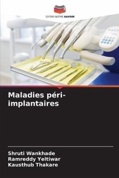 Maladies péri-implantaires - Wankhade, Shruti;Yeltiwar, Ramreddy;Thakare, Kausthub