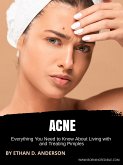 Acne (eBook, ePUB)