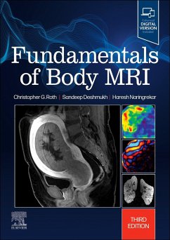 Fundamentals of Body MRI - Roth, Christopher G.; Naringrekar, Haresh; Deshmukh, Sandeep