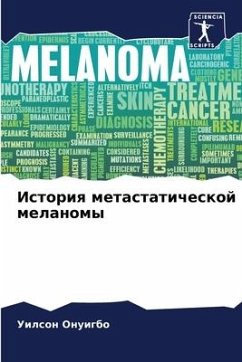 Istoriq metastaticheskoj melanomy - Onuigbo, Uilson